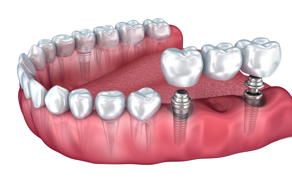 Perion Dental Health Center business image in Tijuana, B.C.